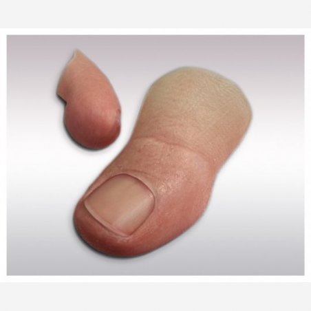 Traces of finger prostheses