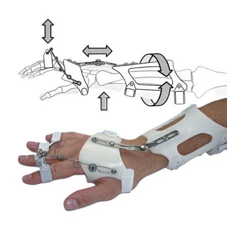 Dynamic wrist-hand splint DAHO1