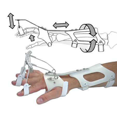 Dynamic extensor wrist-hand splint DAHO22