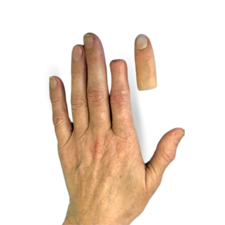 Finger prosthesis - 1